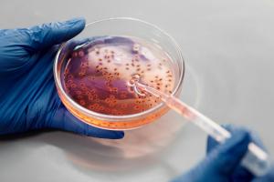 Differential Gene Expression Analysis: Comparing DESeq2, edgeR, and limma