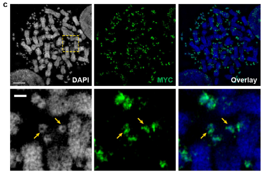 Figure 2  Correlated SEM and confocal light microscopy of chromosomal and ecDNA in COLO320DM cell. .png