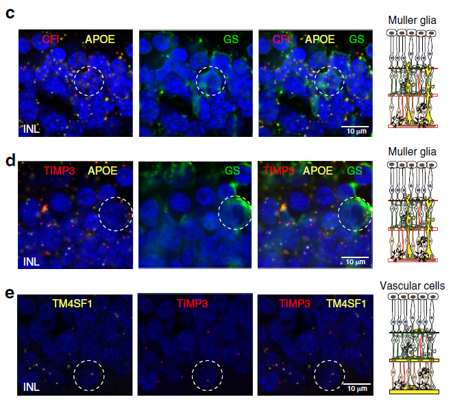 Figure 3 Expression pattern of AMD risk alleles CFI and TIMP3 in the human retina.png